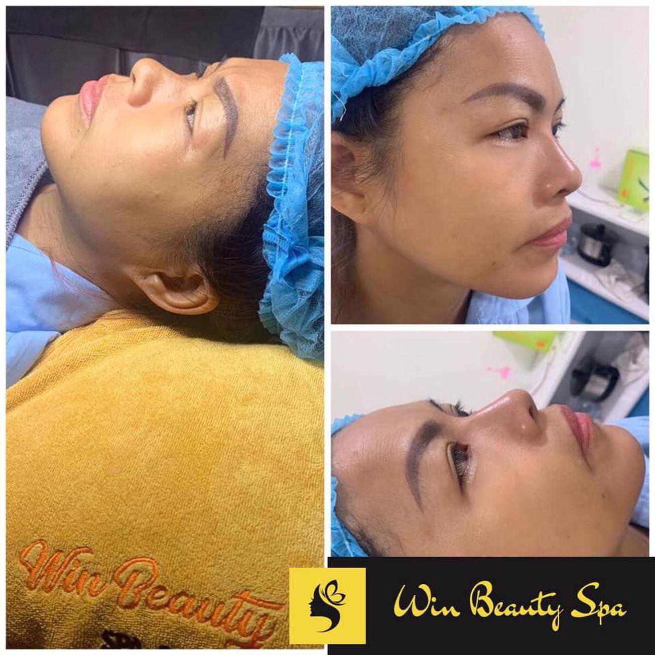 Win Beauty Spa - Trương Công Định 3 gallaries